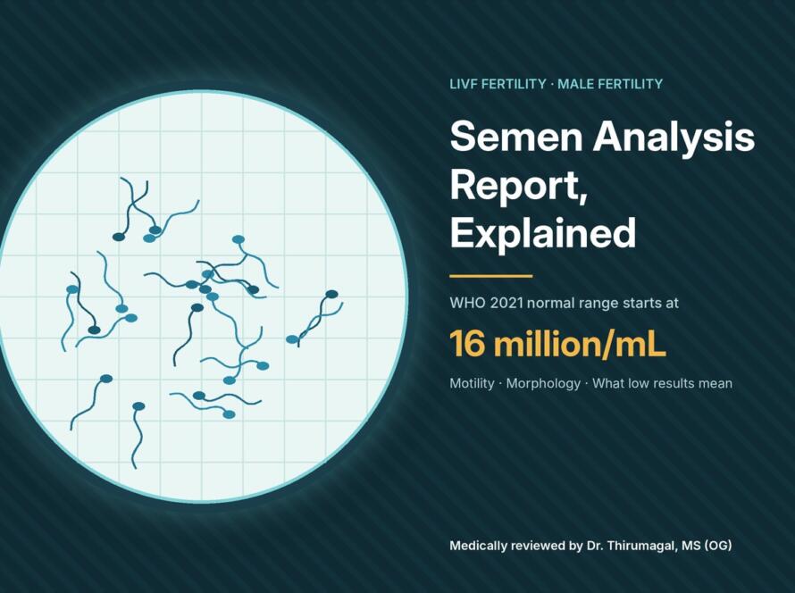 Microscope view of sperm on a counting grid with WHO 2021 normal sperm count of 16 million per mL