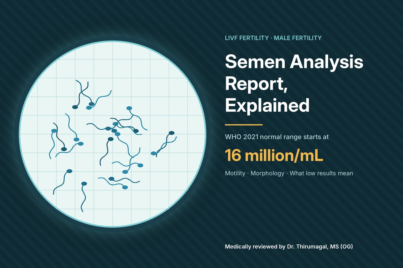 Microscope view of sperm on a counting grid with WHO 2021 normal sperm count of 16 million per mL